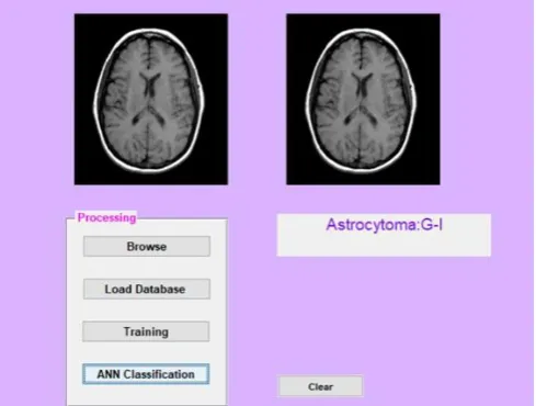 Fig. 9.Grade classification of image 2  