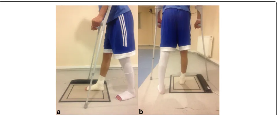 Fig. 1 a, b Clinical pictures of a patient (number 6, 21-year-old male) during the analysis of weight bearing at the gait analysis laboratory