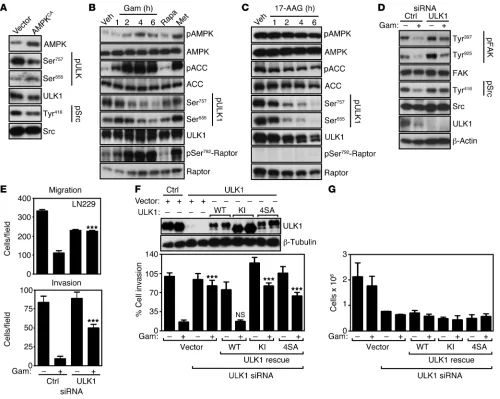 Figure 7ULK1 control of tumor cell motility. (