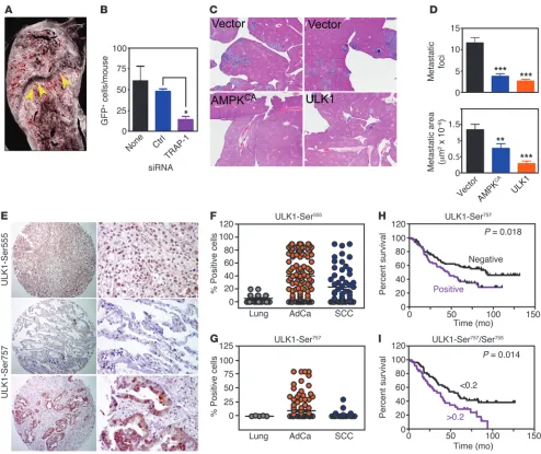 Figure 9Metabolic control of metastasis. (