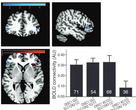 Figure 2DISC1 and SLC12A2 interaction negatively impacts hippocampal con-