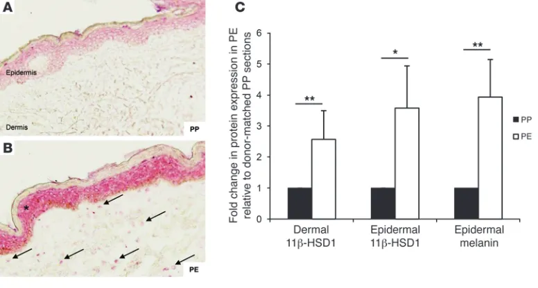 Figure 211-HSD1 expression increases in PE skin. 11
