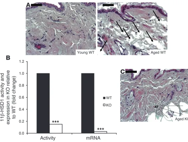 Figure 4Improved collagen density in aged 11