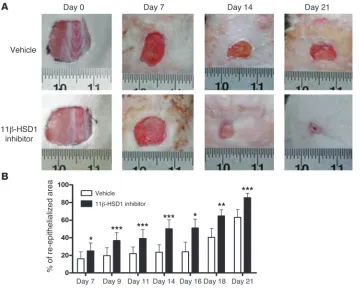 Figure 6Accelerated wound healing in 11β-HSD1 inhibitor–treated mice. (A) Representative images showing improved wound closure in mice treated every 2–3 days with 1% RO151