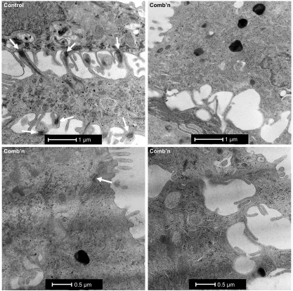 Figure 3 Differentiated AECs exposed to Zn depletion and CSE exhibit a reduction in the frequency of junction complexes.Notes: Representative longitudinal transmission electron micrograph images of adjacent human AECs grown ex vivo at an ALI