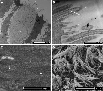 Figure S1 The ex vivo cultures of differentiated primary human AECs share phenotypic barrier structures observed in the airways in vivo.Notes: An important requisite for assessing the epithelial barrier in the context of COPD is establishing a model that c