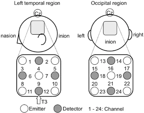 Figure 4. Location of the optodes placed on the left temporal and occipital regions. The distance between each emitter and the cor-responding detector was set at 3 cm