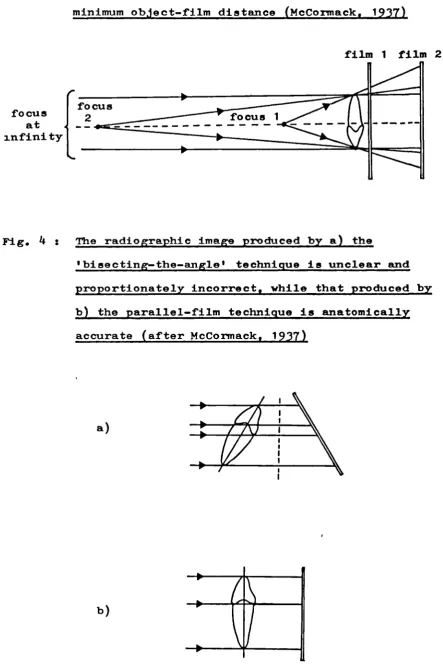 Fig. 3 : Reduced magnification of the radiographic image