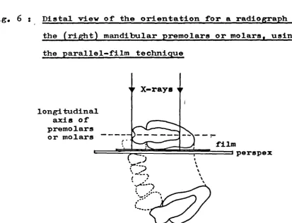 Fig. 6 : Distal view of the orientation for a radiograph of