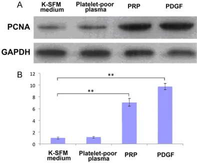 Figure 5. Detection of cell migration ability of the isolated epidermal stem cells by transwell assay