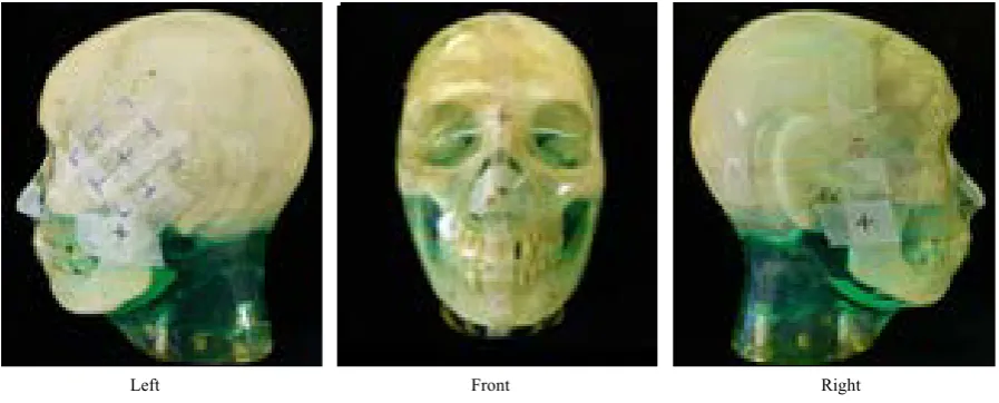 Figure 2. Anthropomorphic phantom (“Eddie”). 
