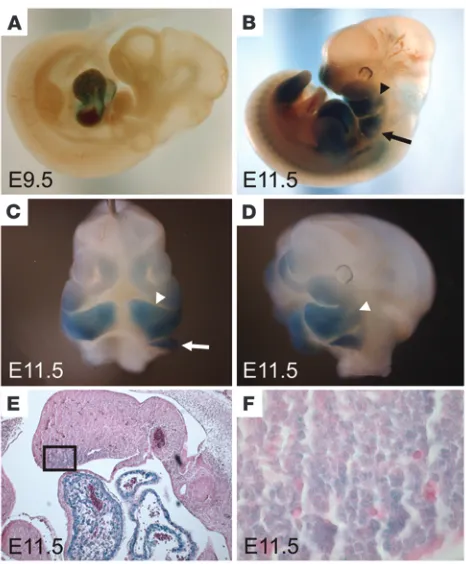Figure 2Ca1.2 expression in pharyngeal arches affects craniofacial 