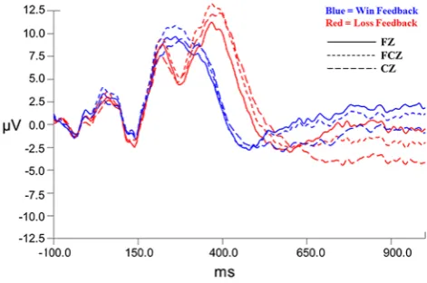 Fig. 2 Grand average waveforms for anterior midline electrodes