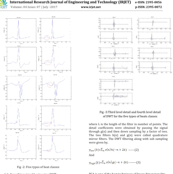 Fig -2: Five types of beat classes 