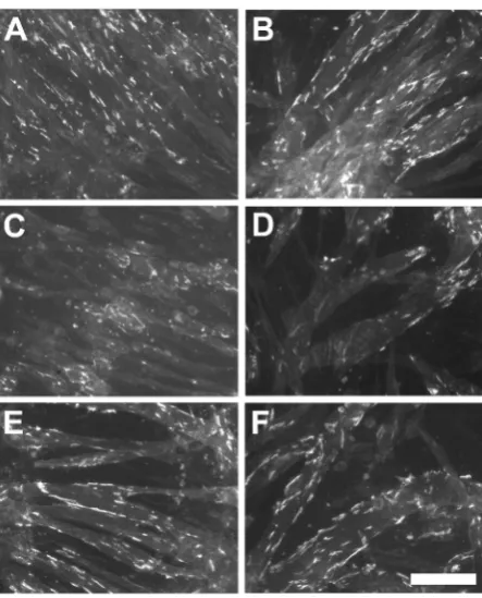 Figure 3. Examples of cell cultures exposed to BPA or DEHP. Fluorescent images were captured from agrin-induced cultures that were untreated (A) (B), or exposed for the last 48 hours of 72 hours in differentiation medium to 10 μM BPA (C), 1 μM BPA (E), 100