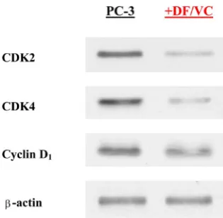 Figure 6. Effects of DF/VC combination on bcl-2 and Bax. After three cancer cells were treated with combination of DF (300 µg/ml) and VC (200 µM) for 24 h, the expressions of bcl-2 and Bax in each control (untreated) and DF/VC-treated cells were analyzed o