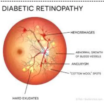 Figure  type of diseases [14] 
