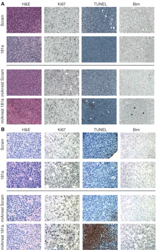 Figure 7Decreased miR-181a expression enhances Bim expression and cell death in murine mam-