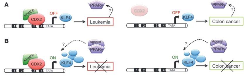 Figure 9Opposing actions of CDX2 in AML and CRC development. (A) In AML (left), aberrant CDX2 expression leads to downregulation of KLF4 (OFF) through binding to distinct sites in the KLF4 regulatory region and recruitment of the H3K4 demethylase KDM5B, th