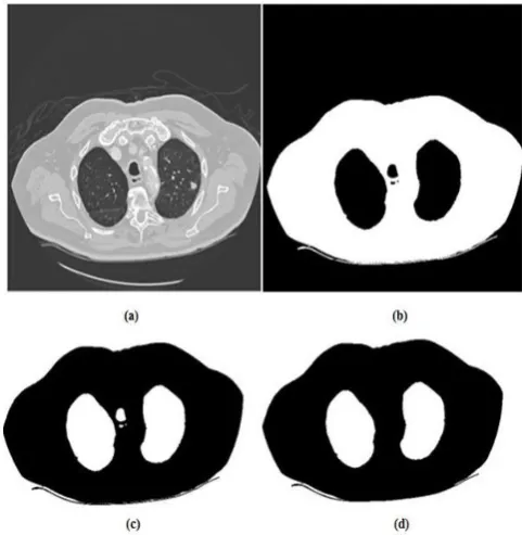 Figure 1 Region grow algorithm masks (a) Before applying region grow, (b) Region grow mask, (c) Inverted region grow mask, and (d) after opening of small clusters  