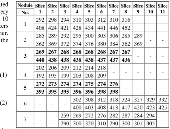 Table 2 A cancerous patient slices with centroid (x,y) changes in consecutive CT slices   