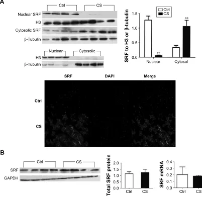 Figure 3 reduced mrna levels of Igf1, Acta1, and Myh2 mrna in Cs-exposed mice.Notes: The mrna levels of Igf1, Acta1, and Myh2 were quantified in the quadriceps muscle of control and CS-group mice by real-time reverse transcription polymerase chain reaction
