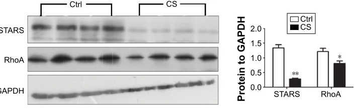 Figure 4 The expression of sTars and rhoa protein in Cs-exposed and control mice.Notes: Western blot analysis showed that the protein levels of sTars and rhoa in the quadriceps muscle of Cs-group mice were markedly lower than those in the control group