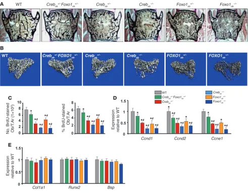 Figure 7Gut-derived serotonin inhibits bone formation by regulating FOXO1-CREB interaction