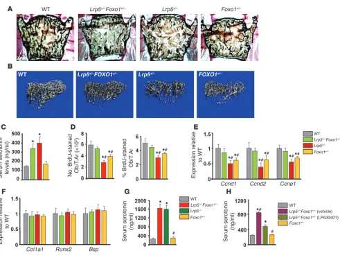 Figure 1Foxo1 haploinsufficiency rescues the low bone formation phenotype of Lrp5+/– mice