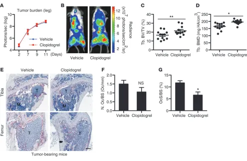 Figure 6Pharmacologic inhibition of P2RY12 protected mice from tumor-associated bone loss