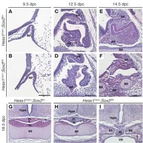 Figure 1Abnormal pituitary morphogenesis and severe anterior lobe 