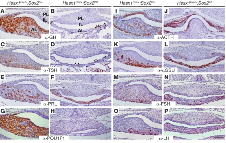 Figure 2Defective terminal differentiation of specific hormone-producing cell types in Hesx1Cre/+;Sox2fl/fl pituitaries at late gestation