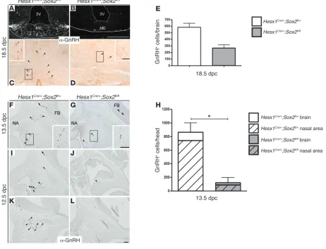 Figure 5Significant reduction of GnRH neurons in the brain and nasal regions of shows the accumulation of GnRH in the axon terminals of GnRH neurons in the median eminence (ME) of the control (hypothalamus, at late gestation (optic area