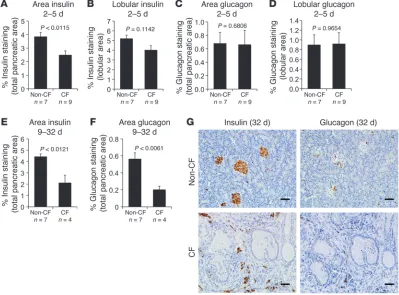 Figure 8Insulin and glucagon content in neonatal CF and non-CF pancreata. (