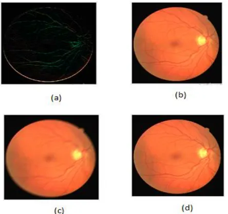 Fig 2: Filtered image output using(a) Laplacian   (b)Average  (c) Motion (d)Gaussian filters respectively 