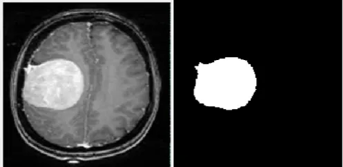 Fig – 5:  Test 2 (a) Original MRI Image (b) Segmented Image  