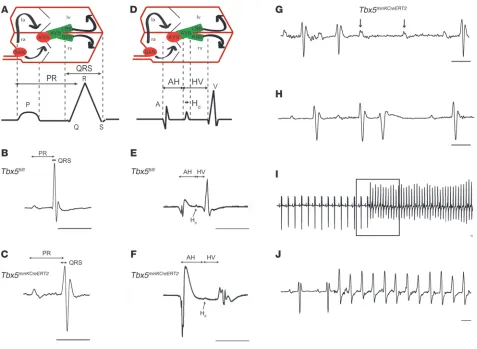 Figure 2Conduction slowing and arrhythmias after removal of 
