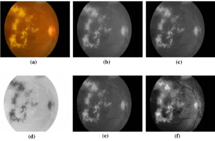 Fig. 9 Preprocessing the output image. a Original image. b Greyscale conversion. c Green channel extraction