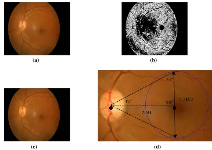 Fig. 10 Extraction of retinal structures. a Optic disc detection. b Blood vessels segmentation