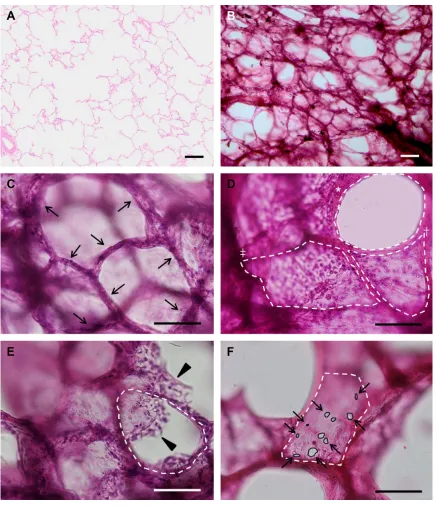 Figure 1 Images (h&e) of the lung showing 4 thicker than the cut edges of the alveolar wall (area of the FU (Abbreviations:μm thick (A) and 300 μm thick (B–F) sections at ×40 magnification (A and B) and ×100 magnification (C–F).Notes: The polyhedral comple