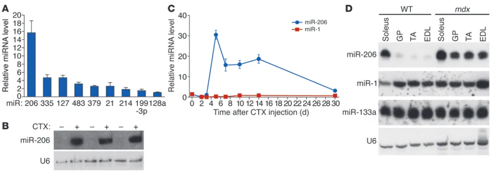 Figure 1miR-206 is upregulated during skeletal muscle regeneration and in mdx mice. (A) Real-time RT-PCR shows upregulated miRNAs in TA 