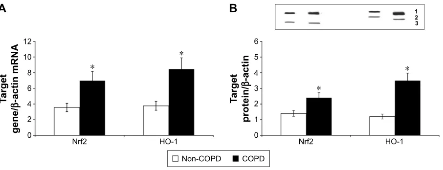 Table 2 Clinical and laboratory data of non-COPD and COPD subjects