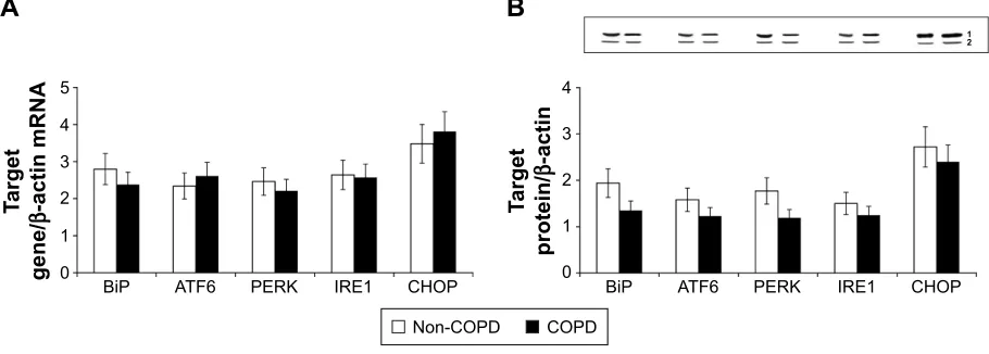 Figure 2 UPr mrna and protein expression in PBMC of non-COPD and COPD subjects.Notes: (A) mrna expression of BiP, aTF6, PerK, Ire1, and ChOP