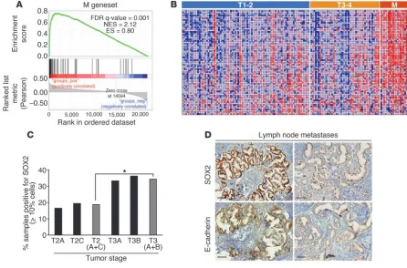 Figure 13Expression of a self-renewal gene network active in PC-3/Mc cells is associated with more advanced stages of prostate cancer