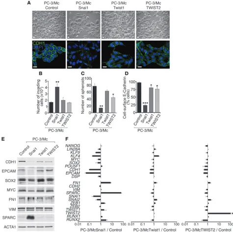 Figure 4Overexpression of Snai1 in PC-3/Mc cells induces EMT and suppresses anchorage-independent growth and the expression of a self-renewal 