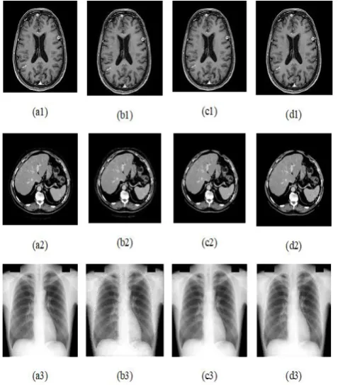 Fig 11: PSNR performance analysis for abdomen images  