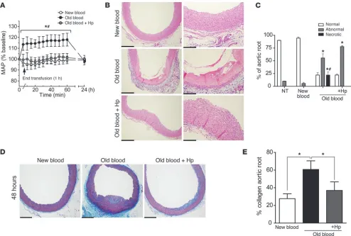 Figure 3Transfusion-related vascular changes. (