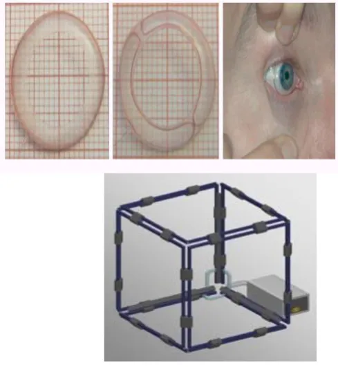 Fig. 3 Sceleral Search Coils 