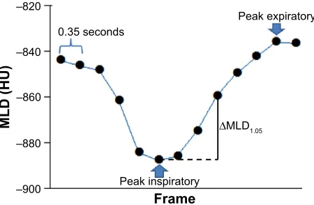 Figure 2 example of the continuous mean lung density (MlD) measurement.Notes: The MlD value is plotted in each of 13 frames (0.35 seconds/frame)