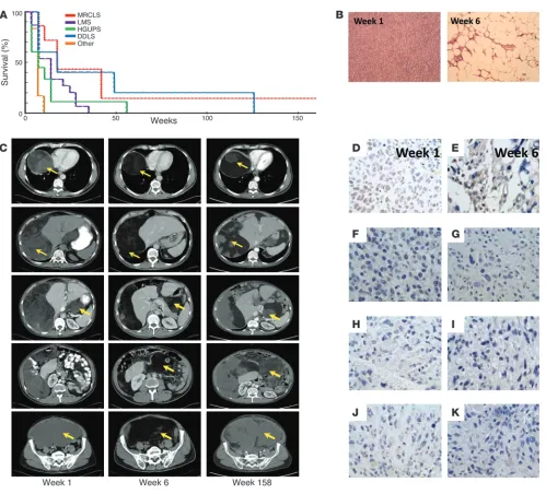Figure 1ET-743–mediated adipocytic differentiation in MRCLS patient 1. (A) Survival curve of ET-743–treated patients by major subtype